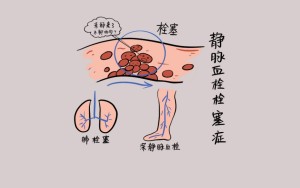 “孕”动健康，轻松“栓”住幸福——给准妈妈们的健康守护指南