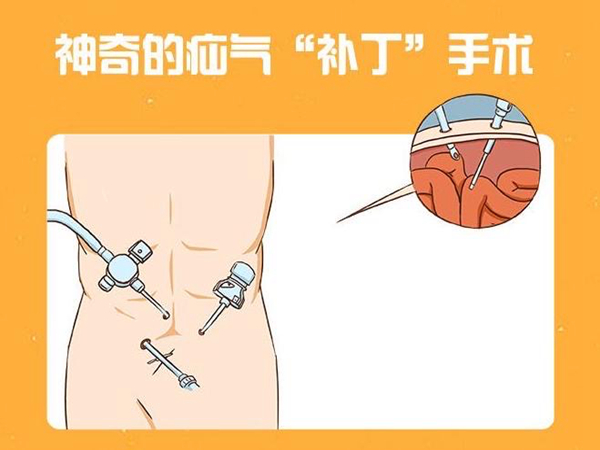 宁南县人民医院