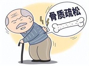 认识骨质疏松:别让骨骼悄悄变脆