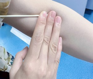 守护健康，防止甲亢