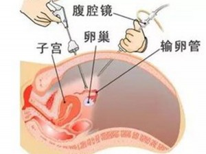   腹腔镜下的大世界