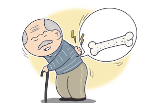 四类高危人群需警惕：骨质疏松可能已经盯上你