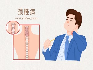 “颈”钟长鸣，你的身体正在报警！