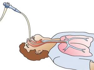 严重肺部感染，纤支镜少不了