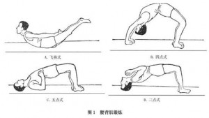 如何预防腰椎间盘突出及正确腰背肌训练