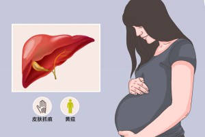 孕期“瘙痒”那些事——警惕妊娠期肝内胆汁淤积症