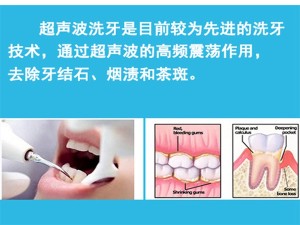 牙垢是怎么产生的？